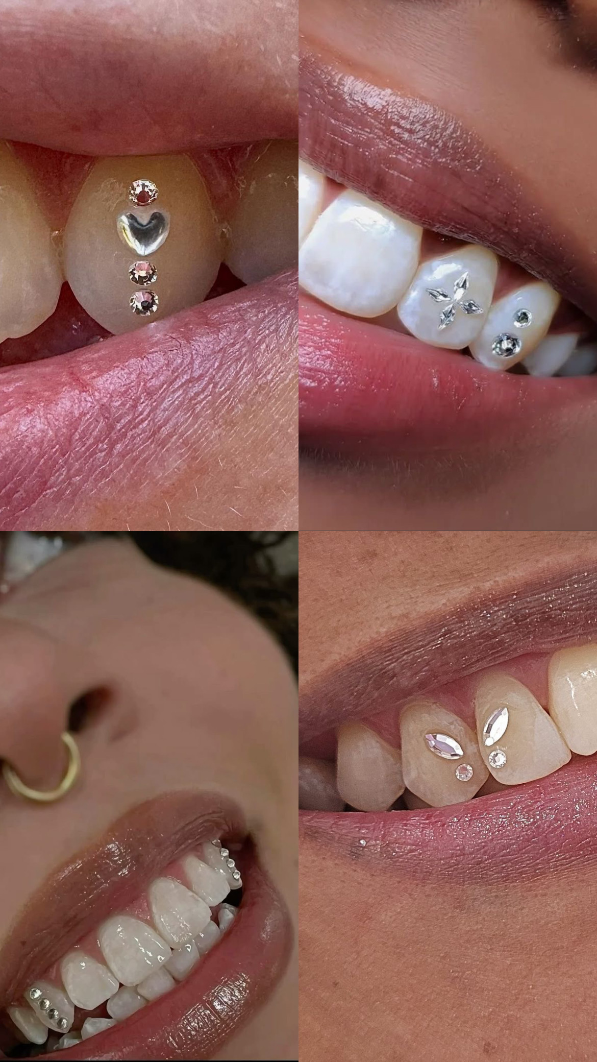 Gemas y accesorios